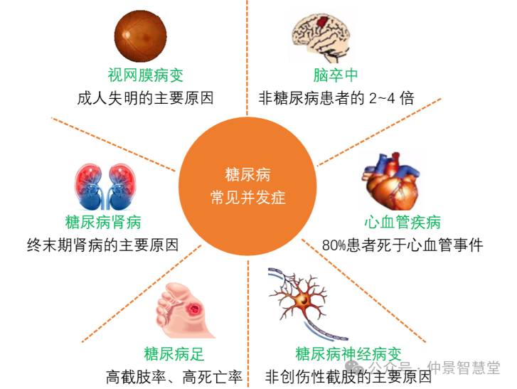 这个糖尿病断根方，别人藏着不说，我来告诉你！