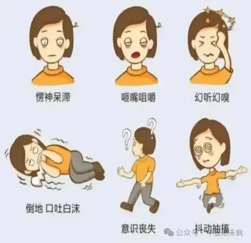 抗痫灵方——何老验方