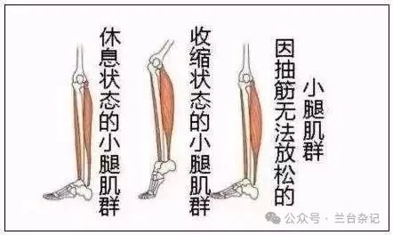 顽固性小腿抽筋一则