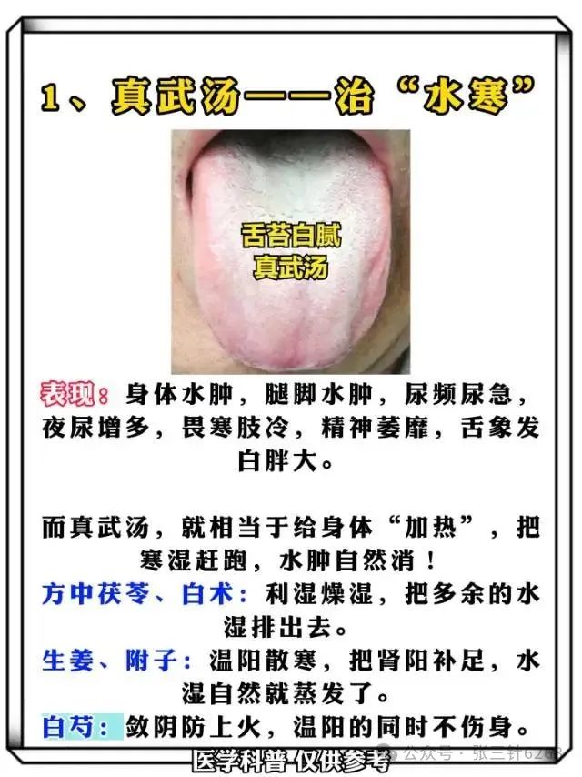 下肢水肿反复难消？此方有神效
